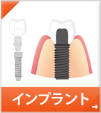 インプラント