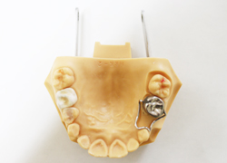 クラウンループ