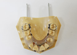 リンガルアーチ